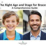 What is the Right Age and Stage to Opt for Braces?